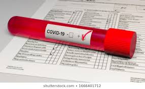 Coronavirus image on testube.